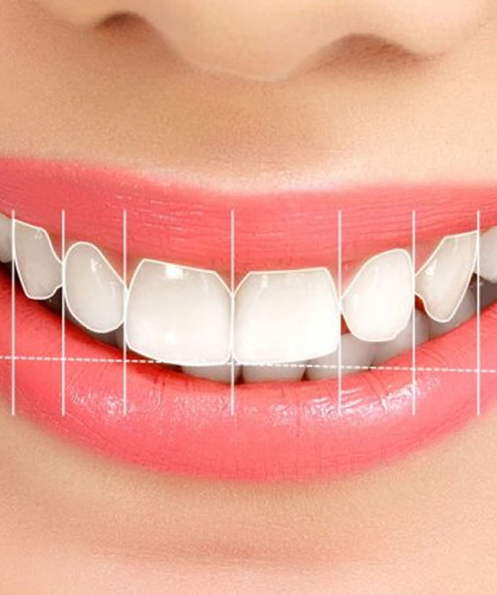 What are Zirconia and Porcelain Veneers? What are the Advantages? Which one should be preferred?